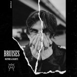 NGHTMRE & Grabbitz - Bruises (Awoltalk Flip)