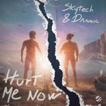 Skytech feat. Dannic - Hurt Me Now