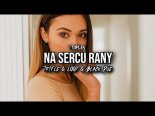 Toples - Na sercu rany (Tr!Fle & LOOP & Black Due REMIX)