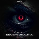 Nutty T - Severe Trauma (The Fallen Remix)