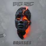 Big RIC - Bruises (Extended Mix)